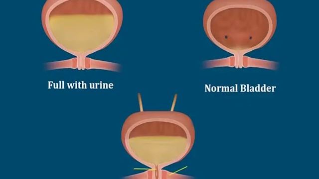 CNS Stimulants: CNS Stimulants of Natural Origin, Synthetic CNS Stimulants