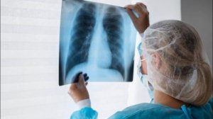 Роспотребнадзор прокомментировал рост заболеваемости микоплазменной пневмонией