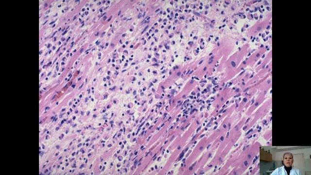 Lecture # 8 смотреть онлайн