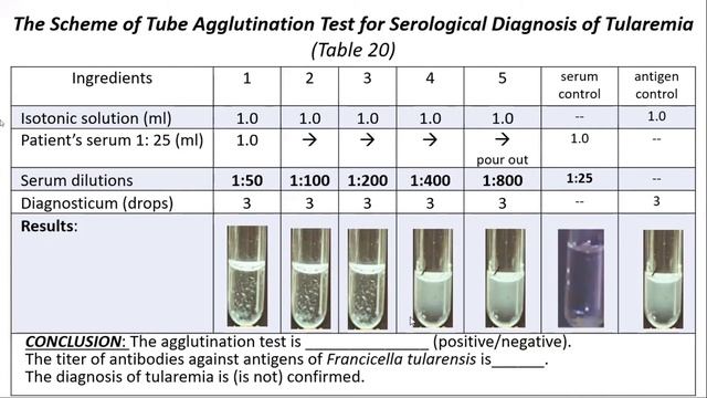 Microbiology: Bacteria - the causative agents of zoonoses смотреть онлайн