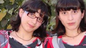 Этих СИАМСКИХ близнецов РАЗДЕЛИЛИ, когда им было по 10 лет. Но судьба не была к ним благосклонна..