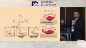 Власов Д.С.: синдром кубитального канала, когда щелкает нерв или трицепс.