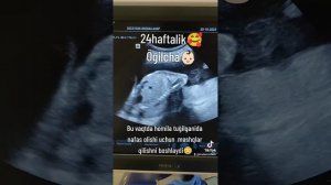 24 haftalik homila🥰👶🏻