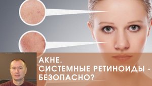 АКНЕ. СИСТЕМНЫЕ РЕТИНОИДЫ - БЕЗОПАСНО?