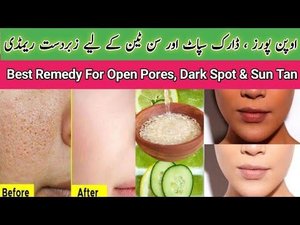 Open Pores and Dark Spot Treatment/Get Glowing, Flawless,Hydrated Skin Naturally