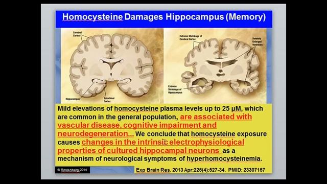 *UPDATED* MTHFR and Homocysteine смотреть онлайн
