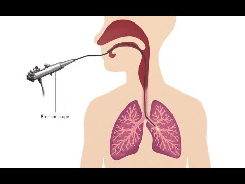 Mediastinoscopy CPT code - simplify medical coding