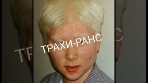 Трахи-ранс - Сопля