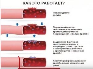 Кровь Разжижать или нет Мифы о разжижении крови1