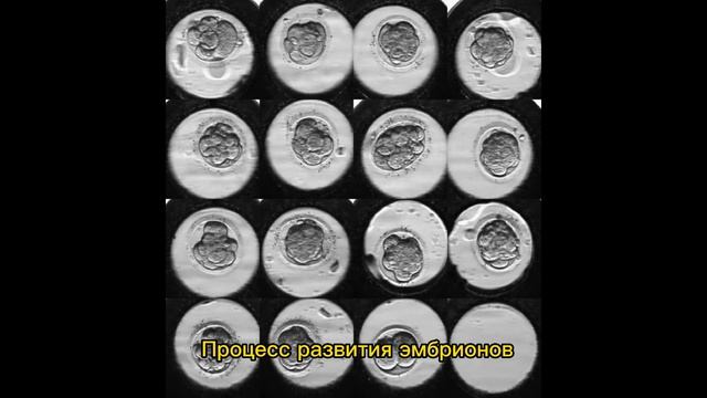 Шевченко Богдана. Изучение хромосомных аномалий плода при искусственном оплодотворении. смотреть онлайн