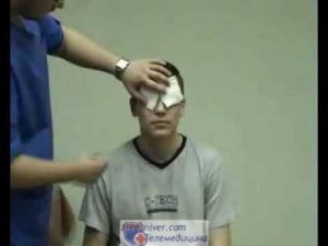 бинокулярная повязка