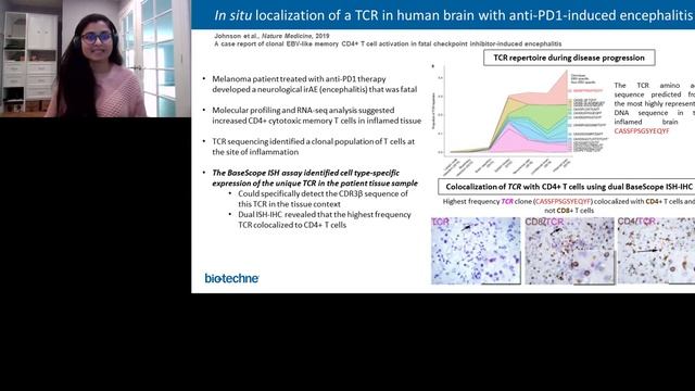 Spatial Mapping of Gene Expression in Tumors using the RNAscope™ Technology смотреть онлайн