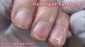 НАЛИПШАЯ КУТИКУЛА?! КАК Я РАБОТАЮ СО СЛОЖНЫМИ РУКАМИ?!