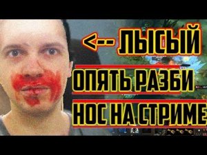 ПАПИЧЬ РАЗБИЛ НОС НА СТРИМЕ!!!!!!!!!! ЖЕСТЬ !!!!!!!!!!!