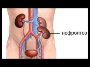 Шесть упражнений ставят почки на место