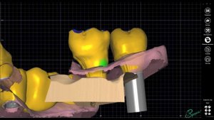 стоматология карвинг зубные техники зубы коронки виниры СПБ анатомия зубов экзокад