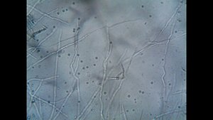 Якорцы стелющиеся и их влияние на семенники