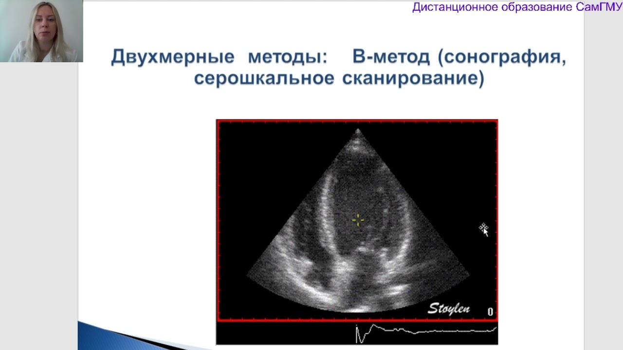 Лекция 4. Ультразвуковые методы исследования. Лектор Романова С. Н.