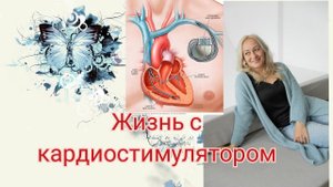 Жизнь с кардиостимулятором