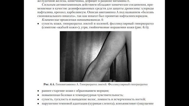 Диетология – 23. Липоевая кислота, ретинол