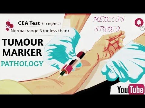Tumour Marker - 2| Carcino -Embryonic Antigen| CEA| Pathology