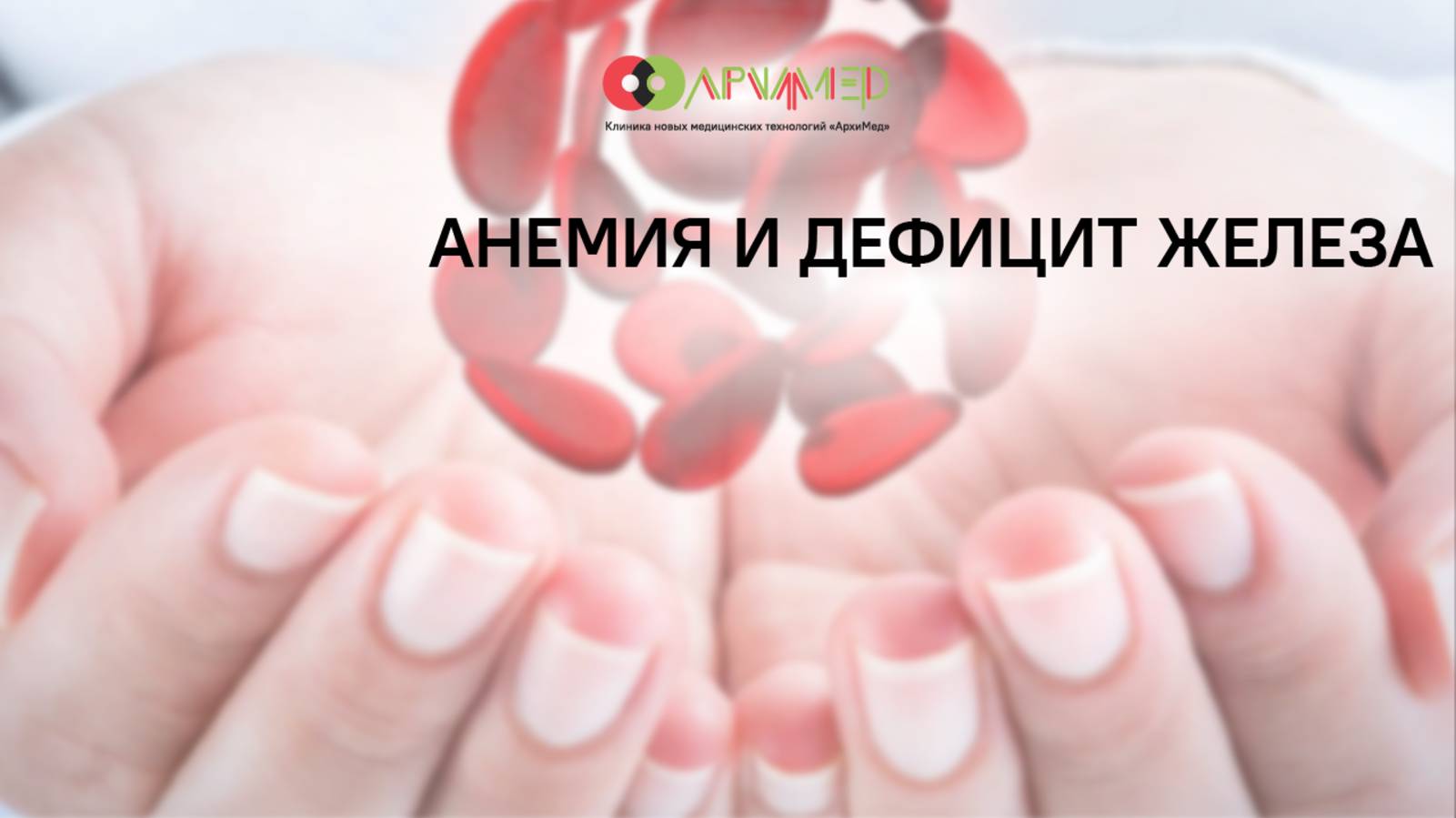 Железодефицитная анемия