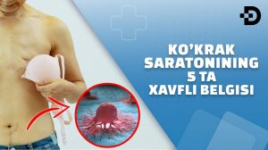 ТАНАНГИЗДА ҚЎҚРАК БЕЗИ САРАТОНИ ЎСИБ БОРАЁТГАНИНГ ДАСТЛАБКИ БЕЛГИЛАРИ