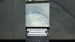 Hyundai Accent 1.6 жрет масло, эндоскопия двигателя. #hyundai #hyundaiaccent#эндоскопия #g4fc