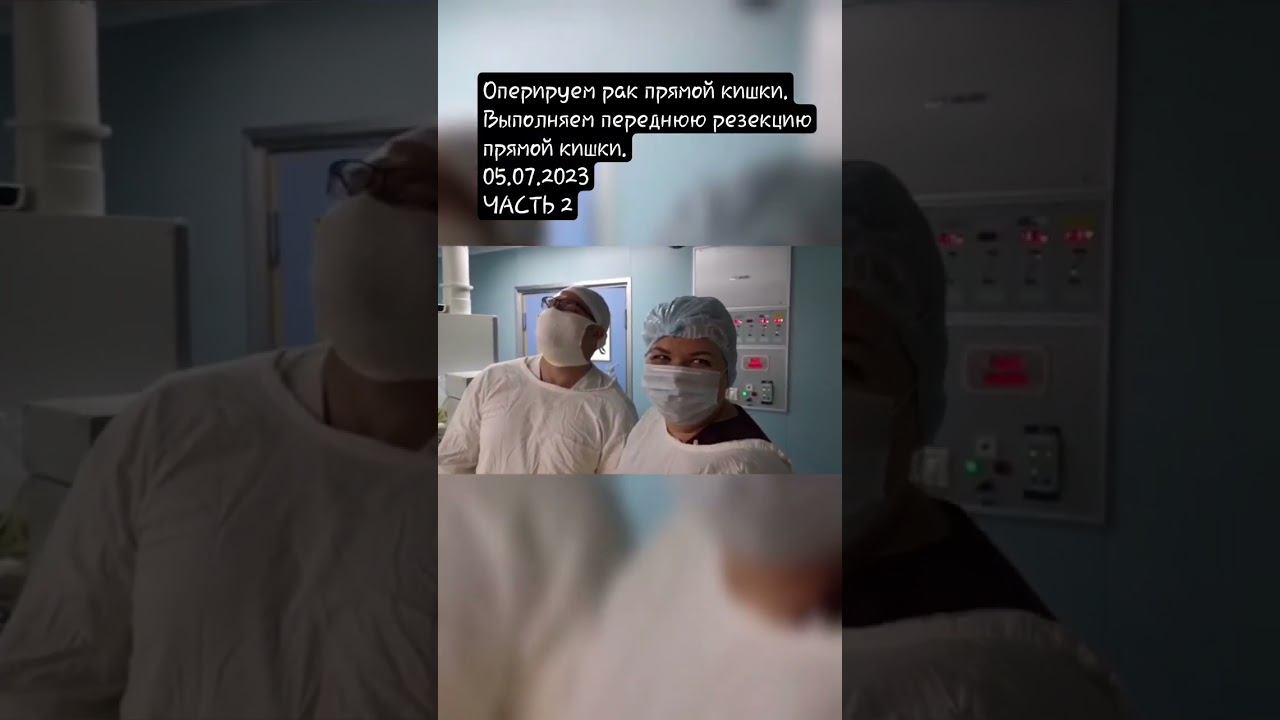 Рак прямой кишки. Выполняем лапароскопическую переднюю резекцию. 05.07.2023 #онколог #рждмедицина