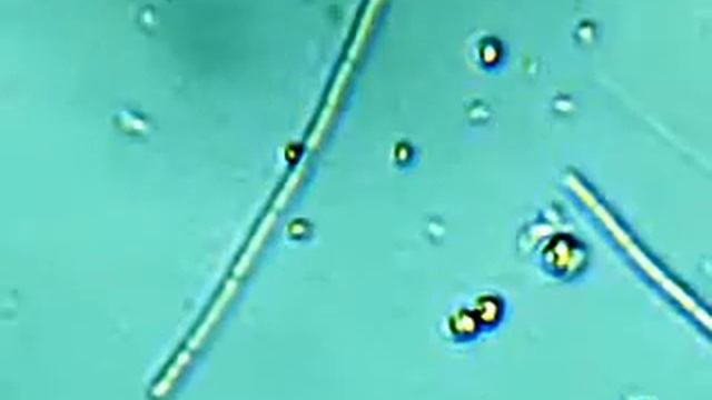 Microscopio: Cianobacteria Creciendo