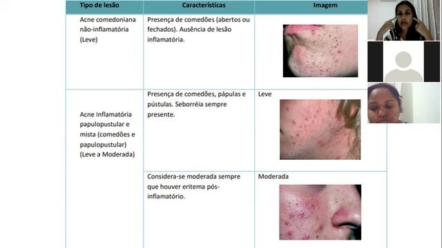 ATF 20 ll 05 Dia 18 03 2021 parte 2 смотреть онлайн
