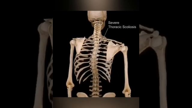 KK-11E EIR смотреть онлайн