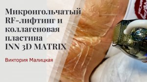 Микроигольчатый RF-лифтинг и коллагеновая пластина INN 3D Matrix бренда «MALITSKAYA»