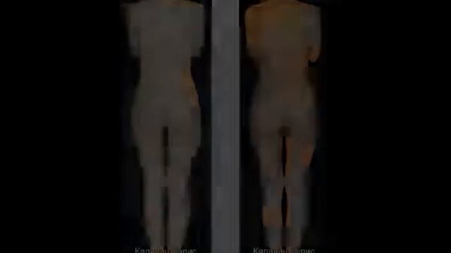 РУЧНАЯ ЛИПОКОРРЕКЦИЯ