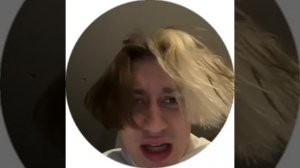 У Некоглая осложнения после перелома!