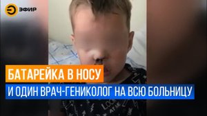 Врачи не смогли вытащить батарейку из носа ребёнка