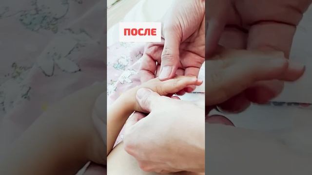 Сила МФР! #реабилитациядетей #мфр #миофасциальныйрелиз #миофасциальныймассаж #реабилитация