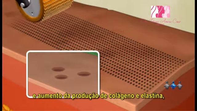 DERMAROLLER смотреть онлайн