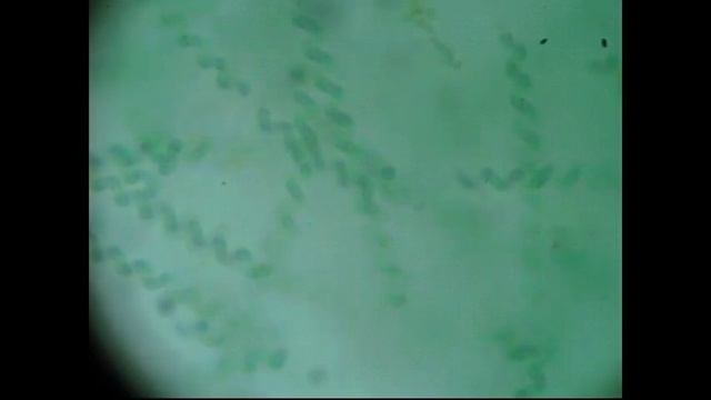 PL1: CYANOBACTERIA & OXYGEN IN THE ATMOSPHERE