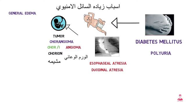 شرح مبسط polyhydramnios смотреть онлайн