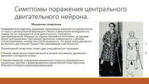 Неврология. Анатомия центрального двигательного нейрона.  Симптомы его поражения