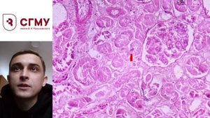 некротический нефроз