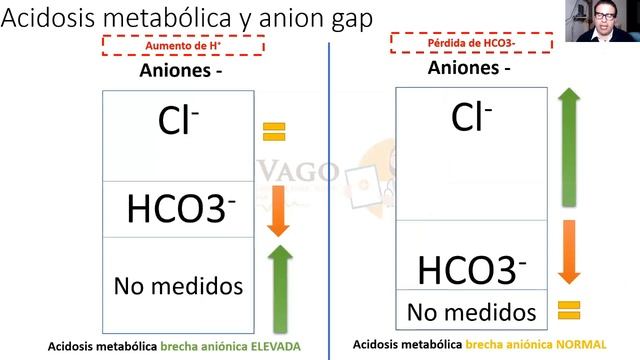 3. Acidosis metabolica