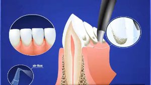 Гигиена и профилактика   Профгигиена  Этапы применения