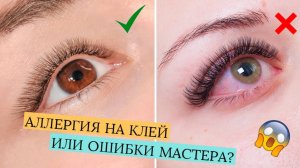 КРАСНЫЕ ГЛАЗА ПОСЛЕ НАРАЩИВАНИЯ РЕСНИЦ! ВСЕ ПРИЧИНЫ И КАК ИЗБЕЖАТЬ?
