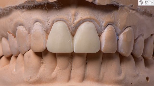 Как выполнять дентальный фотопротокол. Объективы. / How to Dentist