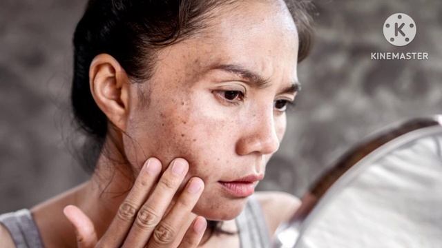 foxtale rapid spot Reduction Serum | remove dark spots, melasma, hyperpigmentation | foxtale drops