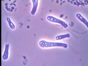 Жгутиконосцы | Flagellates