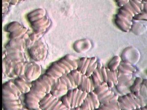 Кровь под микроскопом (монетные столбики) | Blood under the microscope (coin columns)