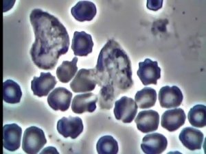 Кровь и макрофаг под микроскопом (Фазовый-контраст) | Blood and macrophage under a microscope